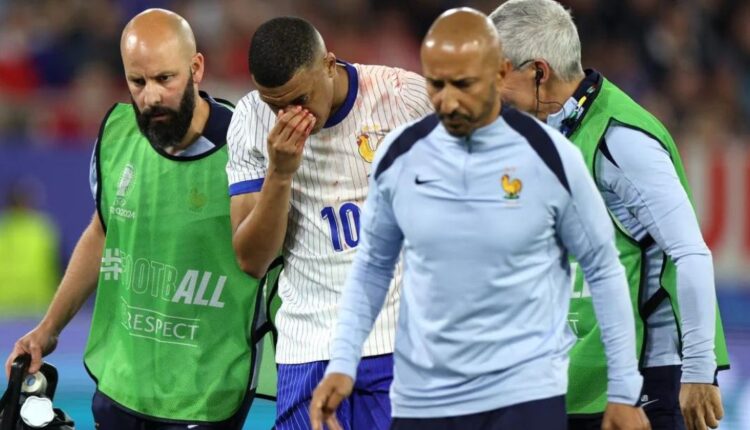 Kylian Mbappé suffers broken nose